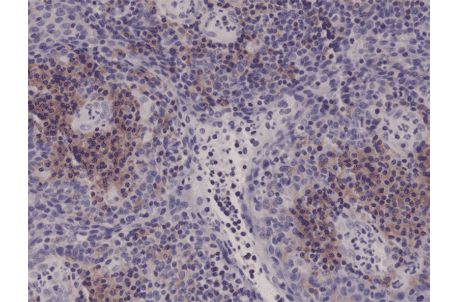 Immunohistochemistry - Anti-Integrin alpha 4 Antibody [RM268] (A121465) - Antibodies.com