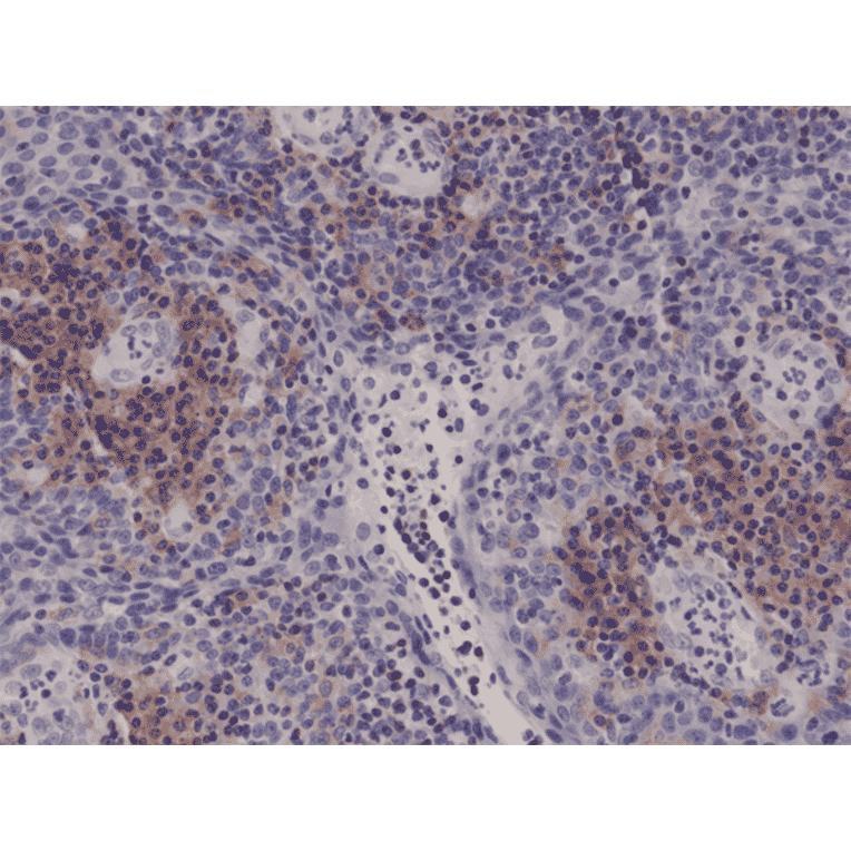 Immunohistochemistry - Anti-Integrin alpha 4 Antibody [RM268] (A121465) - Antibodies.com