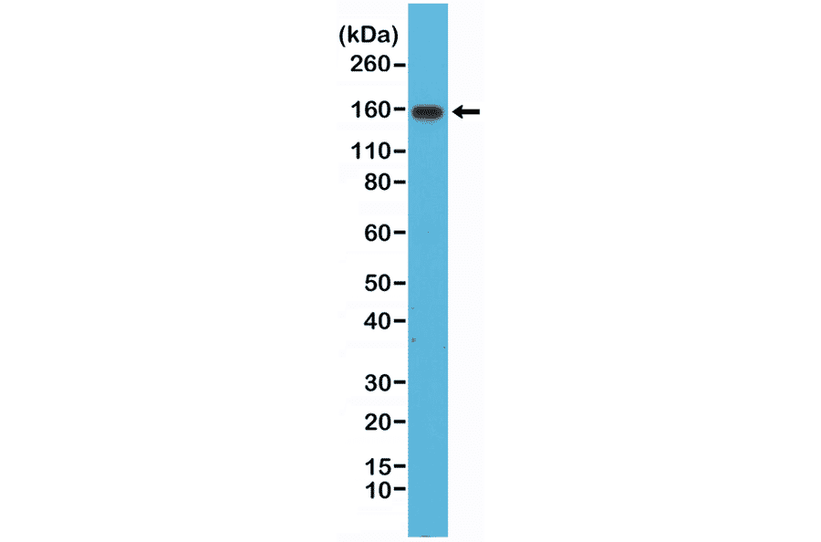 Western Blot - Anti-Integrin alpha 4 Antibody [RM268] (A121410) - Antibodies.com