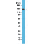 Western Blot - Anti-Integrin alpha 4 Antibody [RM268] (A121410) - Antibodies.com