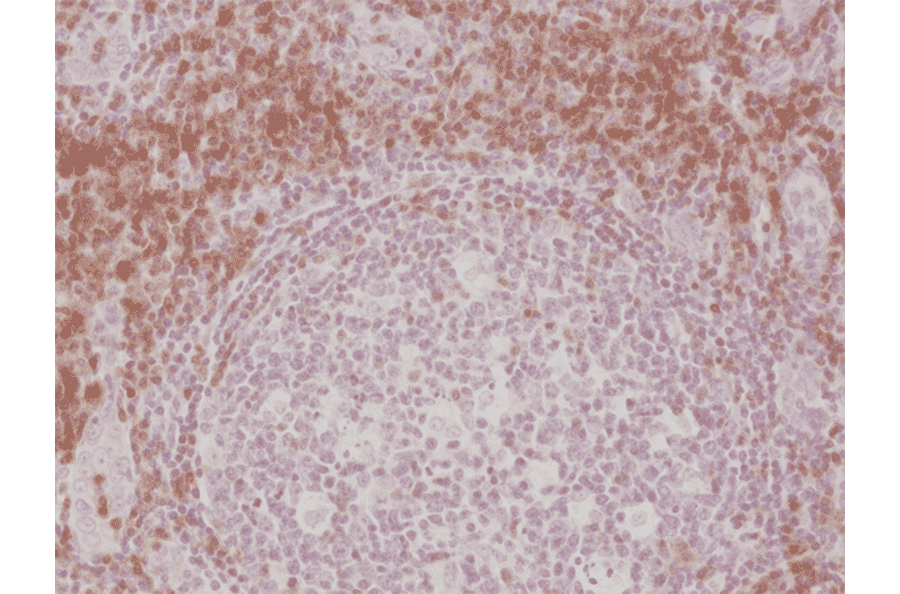 Immunohistochemistry - Anti-CD3 Antibody [RM344] (A121367) - Antibodies.com