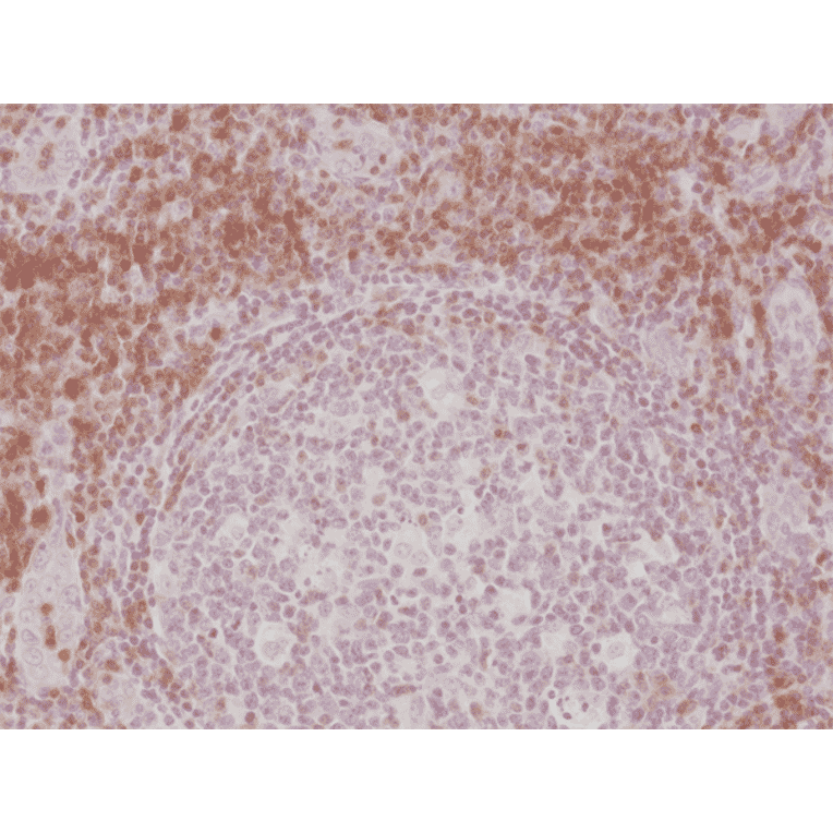 Immunohistochemistry - Anti-CD3 Antibody [RM344] (A121367) - Antibodies.com
