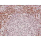 Immunohistochemistry - Anti-CD3 Antibody [RM344] (A121367) - Antibodies.com