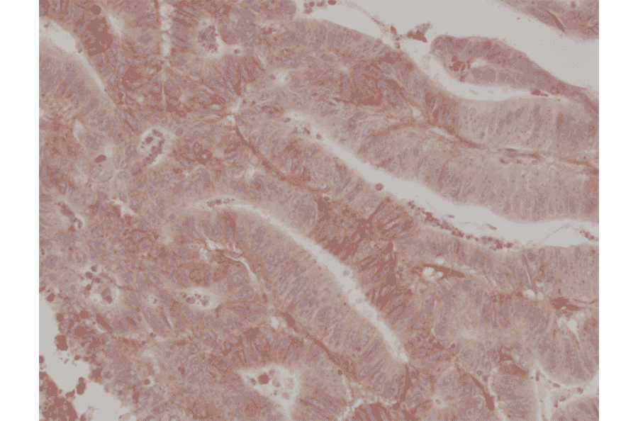 Immunohistochemistry - Anti-CD276 Antibody [RM335] (A121251) - Antibodies.com