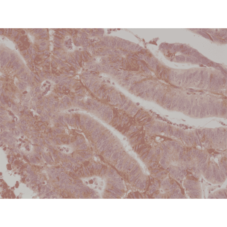 Immunohistochemistry - Anti-CD276 Antibody [RM335] (A121251) - Antibodies.com