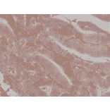 Immunohistochemistry - Anti-CD276 Antibody [RM335] (A121251) - Antibodies.com