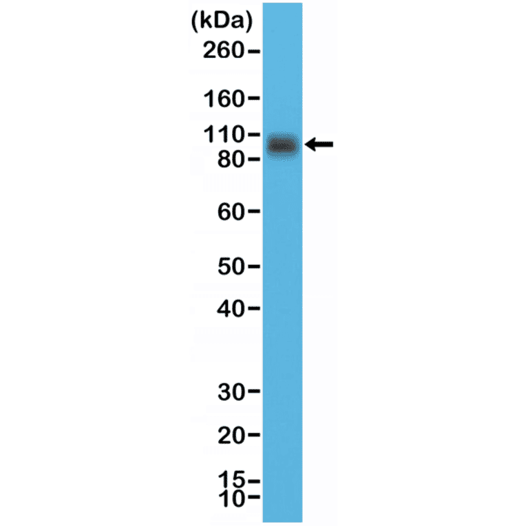 Western Blot - Anti-CD276 Antibody [RM335] (A121412) - Antibodies.com