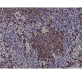 Immunohistochemistry - Anti-CD20 Antibody [RM272] (A121463) - Antibodies.com
