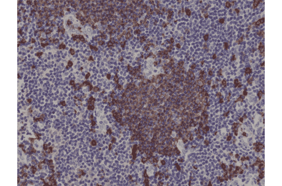 Immunohistochemistry - Anti-CD20 Antibody [RM272] (A121463) - Antibodies.com