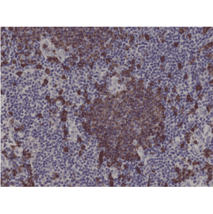 Immunohistochemistry - Anti-CD20 Antibody [RM272] (A121463) - Antibodies.com