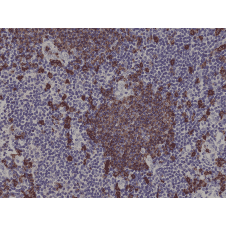 Immunohistochemistry - Anti-CD20 Antibody [RM272] (A121463) - Antibodies.com