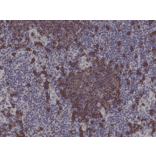 Immunohistochemistry - Anti-CD20 Antibody [RM272] (A121463) - Antibodies.com