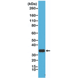 Western Blot - Anti-CD20 Antibody [RM272] (A121413) - Antibodies.com