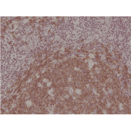 Immunohistochemistry - Anti-CD19 Antibody [RM332] (A121382) - Antibodies.com