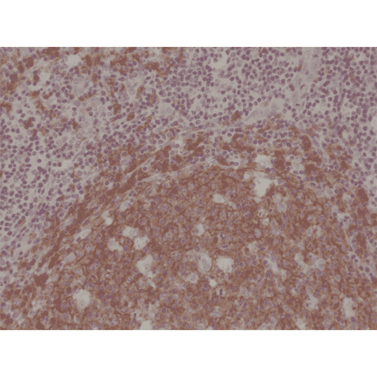 Immunohistochemistry - Anti-CD19 Antibody [RM332] (A121382) - Antibodies.com