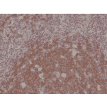 Immunohistochemistry - Anti-CD19 Antibody [RM332] (A121382) - Antibodies.com