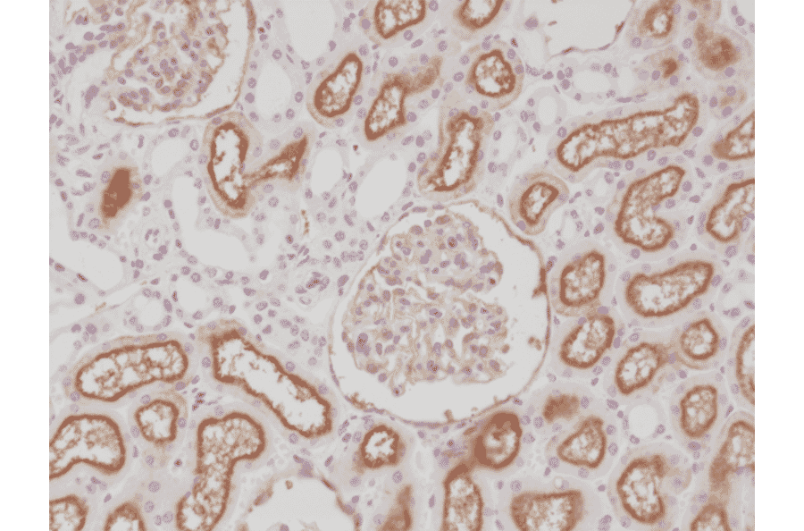 Immunohistochemistry - Anti-CD10 Antibody [RM337] (A121415) - Antibodies.com