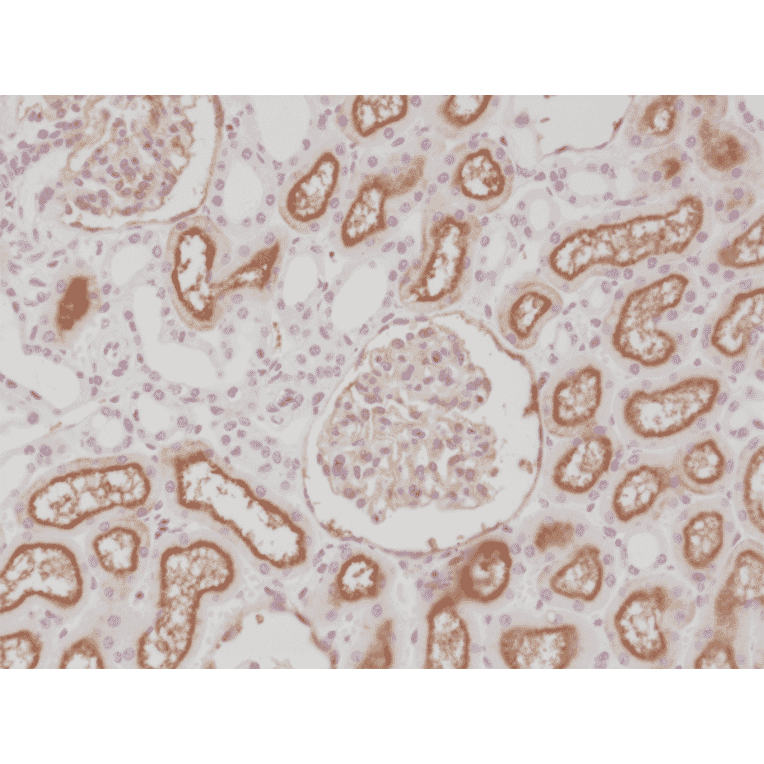 Immunohistochemistry - Anti-CD10 Antibody [RM337] (A121415) - Antibodies.com