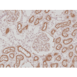 Immunohistochemistry - Anti-CD10 Antibody [RM337] (A121415) - Antibodies.com