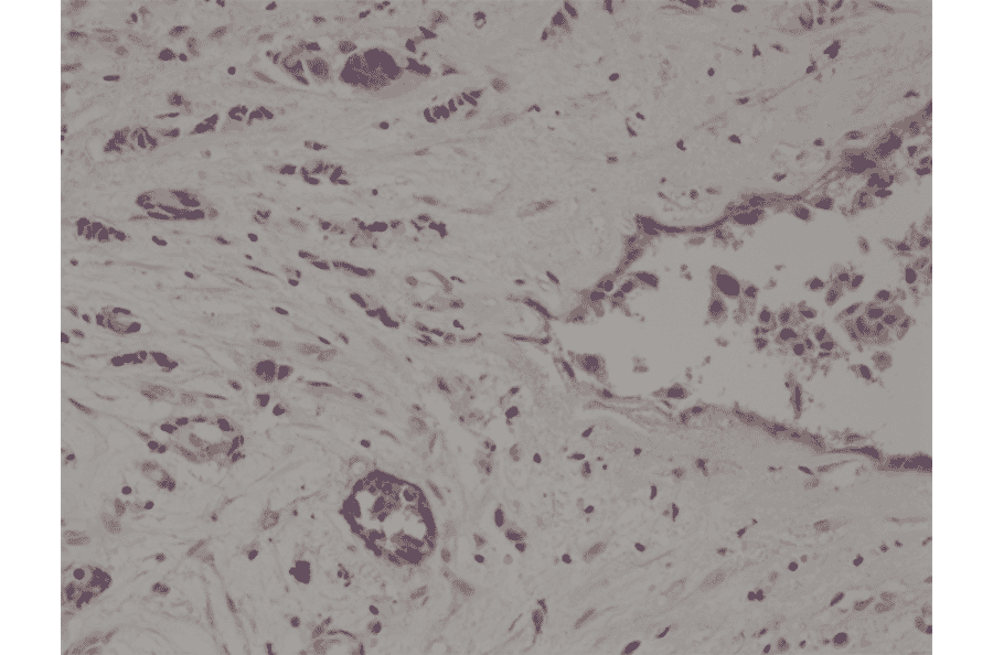 Immunohistochemistry - Anti-CD10 Antibody [RM337] (A121412) - Antibodies.com