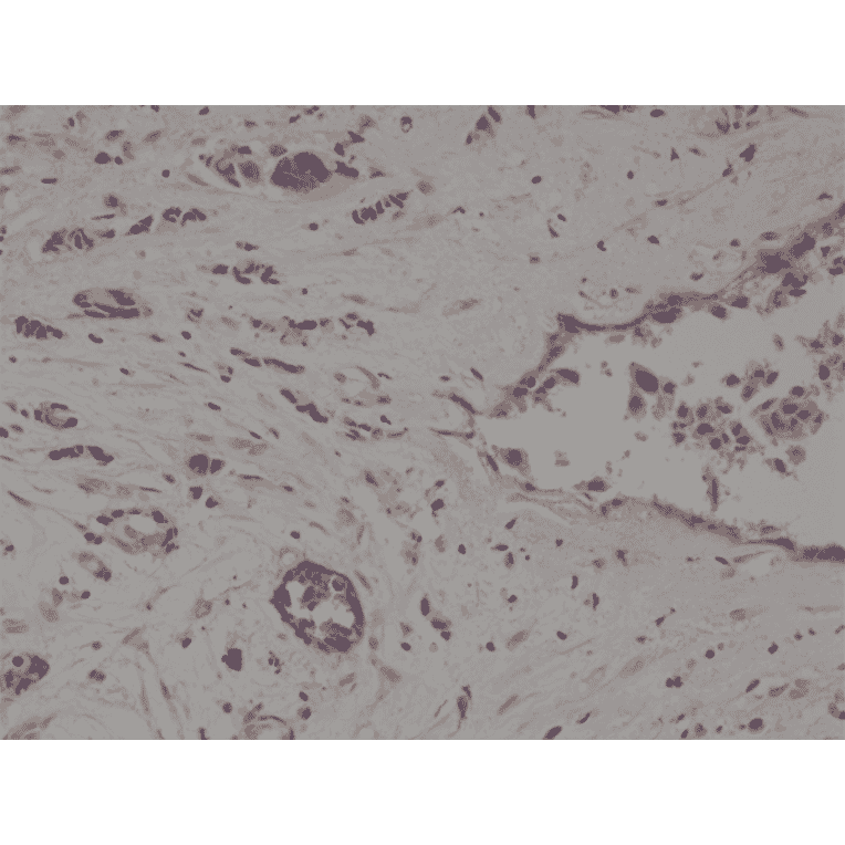 Immunohistochemistry - Anti-CD10 Antibody [RM337] (A121412) - Antibodies.com