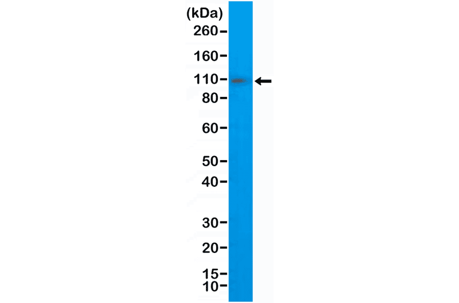 Western Blot - Anti-CD10 Antibody [RM337] (A121415) - Antibodies.com