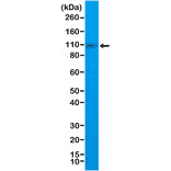 Western Blot - Anti-CD10 Antibody [RM337] (A121415) - Antibodies.com