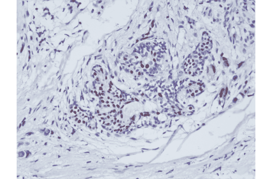 Immunohistochemistry - Anti-Estrogen Receptor Antibody [RM292] (A121298) - Antibodies.com