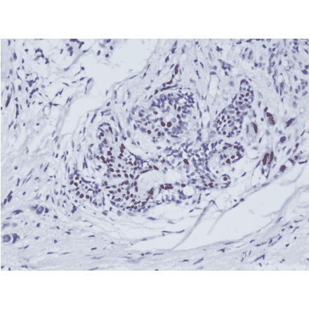 Immunohistochemistry - Anti-Estrogen Receptor Antibody [RM292] (A121298) - Antibodies.com