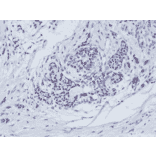 Immunohistochemistry - Anti-Estrogen Receptor Antibody [RM292] (A121298) - Antibodies.com