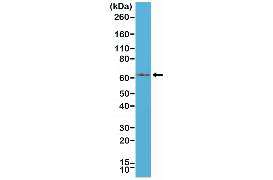 Western Blot - Anti-Estrogen Receptor Antibody [RM292] (A121416) - Antibodies.com