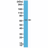 Western Blot - Anti-Estrogen Receptor Antibody [RM292] (A121416) - Antibodies.com