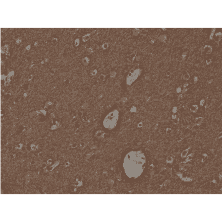 Immunohistochemistry - Anti-Syntaxin 1a Antibody [RM367] (A121450) - Antibodies.com