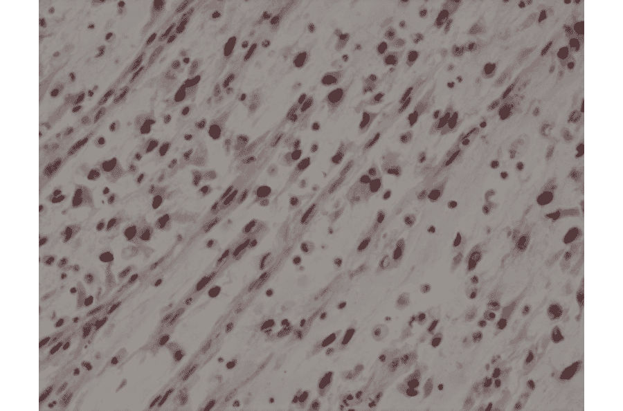 Immunohistochemistry - Anti-MyoD1 Antibody [RM369] (A121431) - Antibodies.com