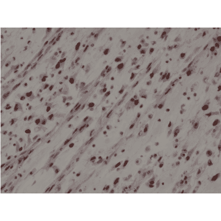 Immunohistochemistry - Anti-MyoD1 Antibody [RM369] (A121431) - Antibodies.com