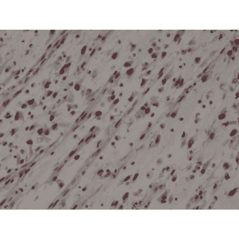 Immunohistochemistry - Anti-MyoD1 Antibody [RM369] (A121431) - Antibodies.com