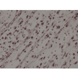Immunohistochemistry - Anti-MyoD1 Antibody [RM369] (A121431) - Antibodies.com