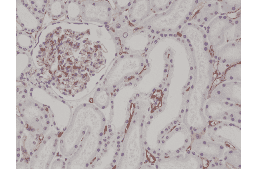 Immunohistochemistry - Anti-CD34 Antibody [RM300] (A121384) - Antibodies.com