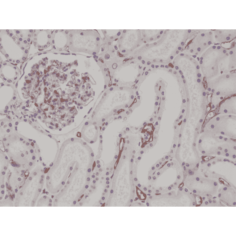 Immunohistochemistry - Anti-CD34 Antibody [RM300] (A121384) - Antibodies.com