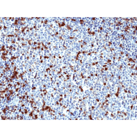 Immunohistochemistry - Anti-ZAP70 Antibody [RM408] (A121376) - Antibodies.com