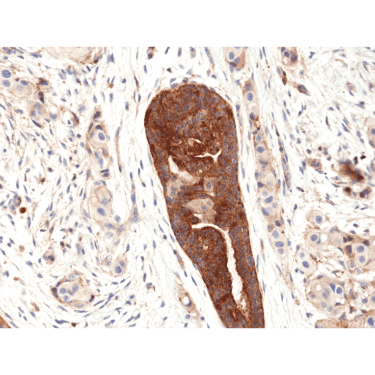 Immunohistochemistry - Anti-VEGFA Antibody [RM391] (A121302) - Antibodies.com