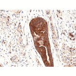 Immunohistochemistry - Anti-VEGFA Antibody [RM391] (A121302) - Antibodies.com