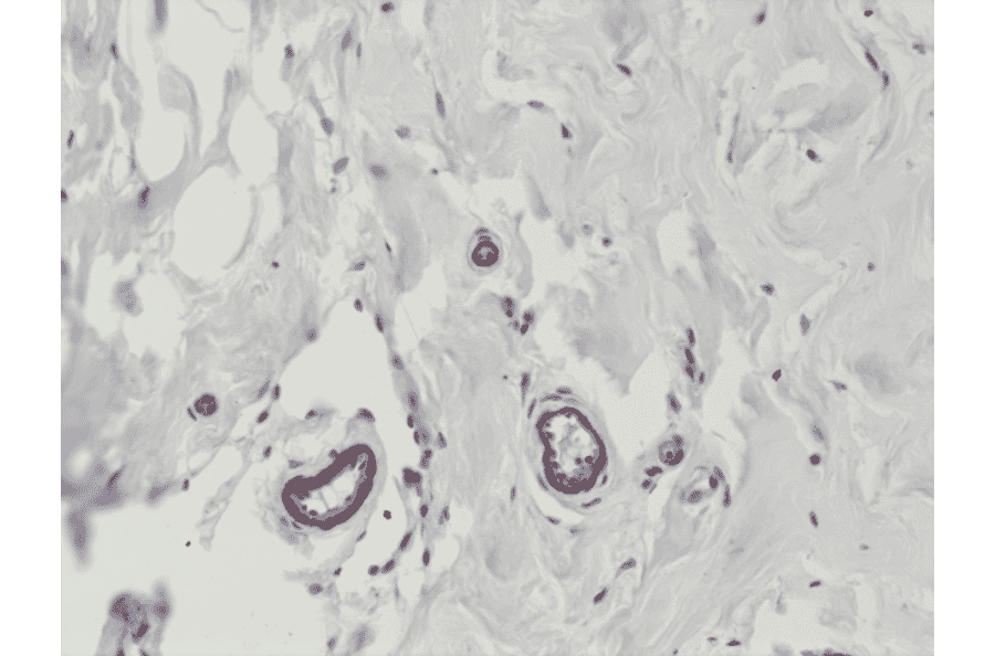 Immunohistochemistry - Anti-VEGFA Antibody [RM391] (A121422) - Antibodies.com