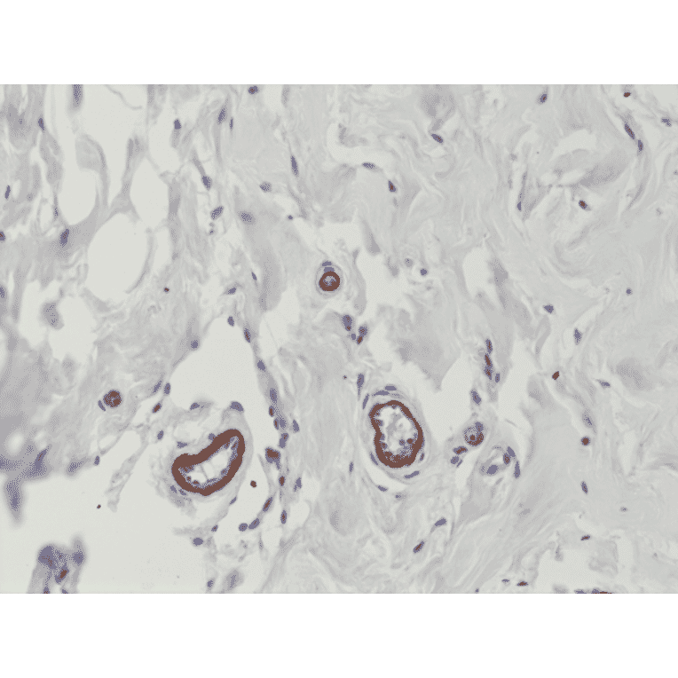 Immunohistochemistry - Anti-VEGFA Antibody [RM391] (A121422) - Antibodies.com