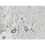 Immunohistochemistry - Anti-VEGFA Antibody [RM391] (A121422) - Antibodies.com