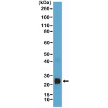 Western Blot - Anti-VEGFA Antibody [RM391] (A121422) - Antibodies.com