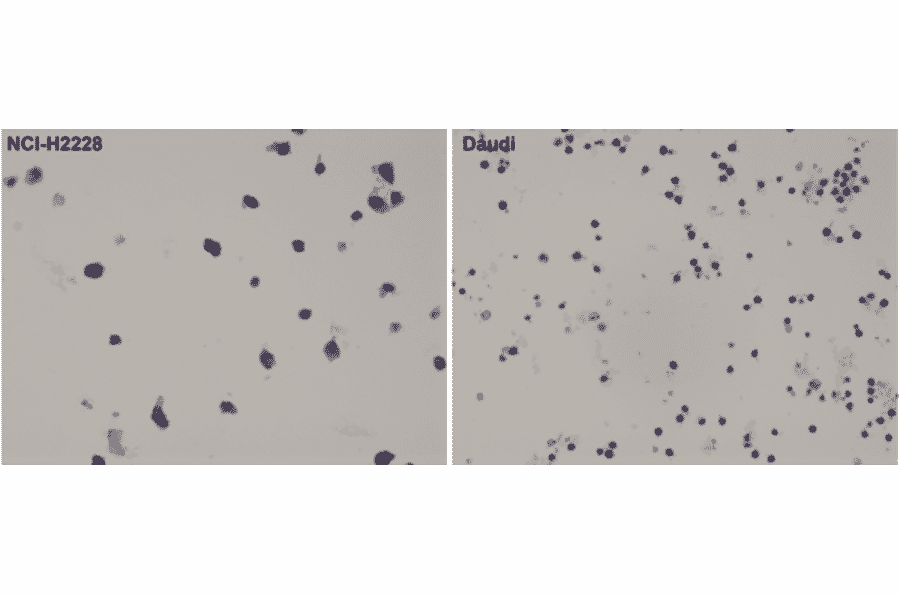 Immunohistochemistry - Anti-ALK Antibody [RM361] (A121423) - Antibodies.com