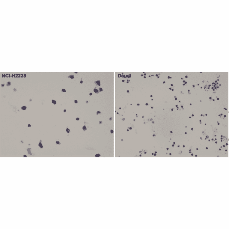 Immunohistochemistry - Anti-ALK Antibody [RM361] (A121423) - Antibodies.com