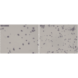 Immunohistochemistry - Anti-ALK Antibody [RM361] (A121423) - Antibodies.com