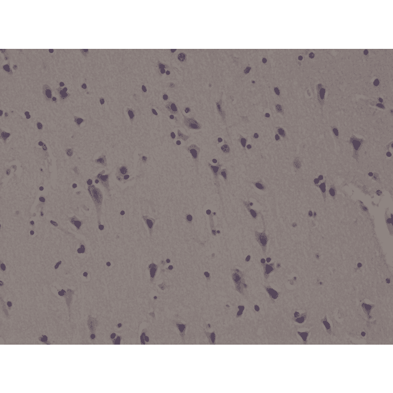 Immunohistochemistry - Anti-ALK Antibody [RM361] (A121362) - Antibodies.com